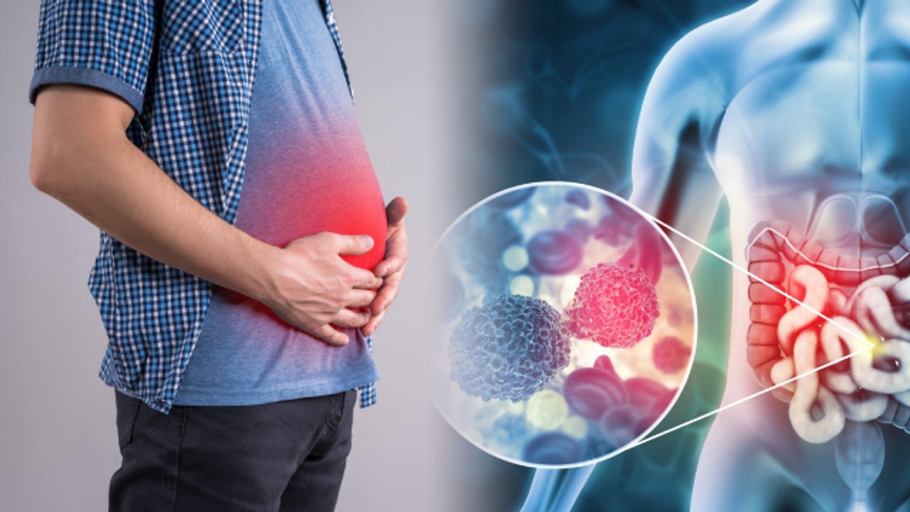 पेट में बार बार Bloating होना Rectal Cancer Symptoms, ये है Risk Factor | Boldsky