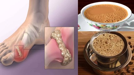 Tea Or Coffee, यूरिक एसिड के मरीज को क्या पीना चाहिए | Boldsky