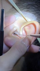 Técnica Relaxante de Limpeza de Ouvido pelos Chineses