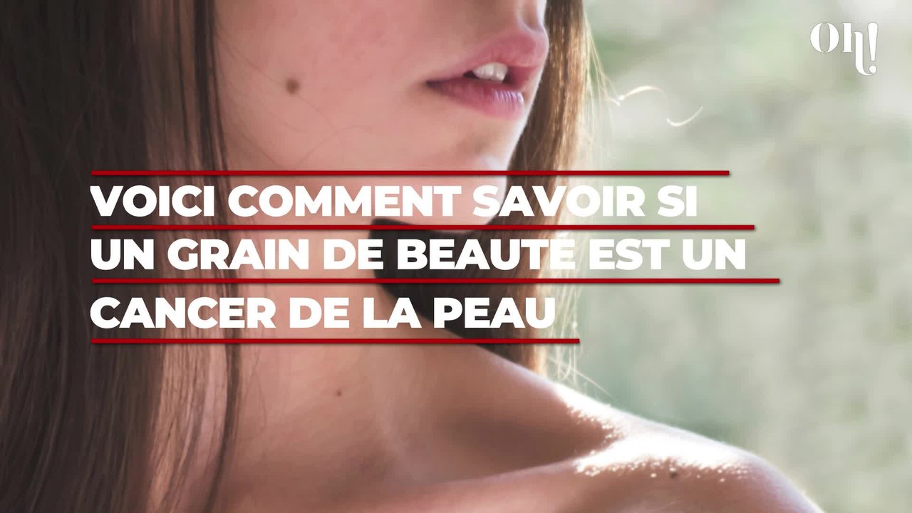 Voici comment savoir si un grain de beauté est un cancer de la peau ...
