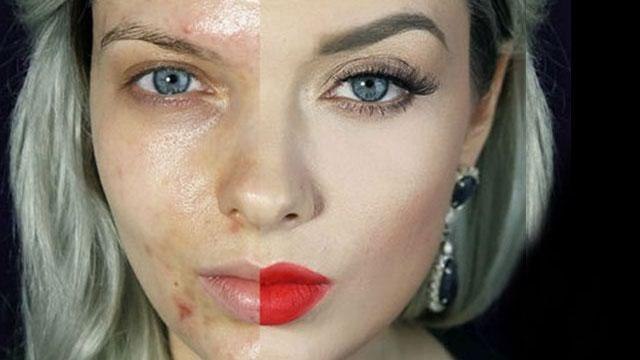 Star di Youtube si toglie il make up e mostra i segni dell’acne, travolta dagli insulti in Rete