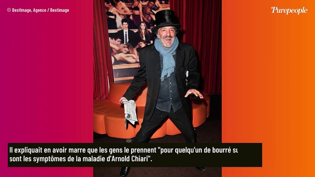 Rachid Taha mort à 59 ans : cette malformation dont il souffrait dans la plus grande discrétion