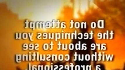 The Dog Whisperer Season 3 Episode 11 Dexter And Nasir (The Diva's Miracle Worker)