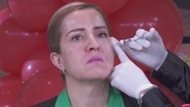 Rejuvenece con bótox y logra un rostro renovado para las Fiestas Patrias