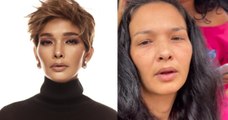 Tayang Muka Tanpa Mekap & Filter, Zahnita Wilson Tetap Cantik!