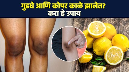 गुडघे काळे दिसतात? करा हे उपाय | Home Remedies To Get Rid Of Dark Knees | AI2