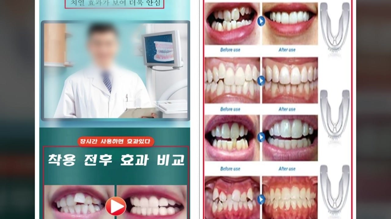 해외 직구 투명치아교정기...과대 광고 무더기 적발 / YTN