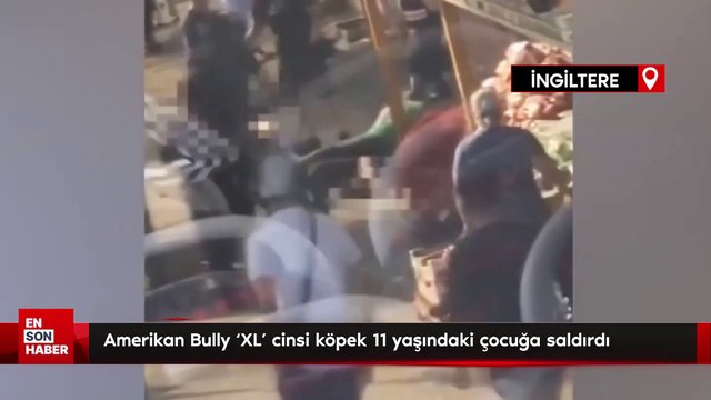 İngiltere'de, Amerikan Bully ‘XL’ cinsi köpek 11 yaşındaki çocuğa saldırdı