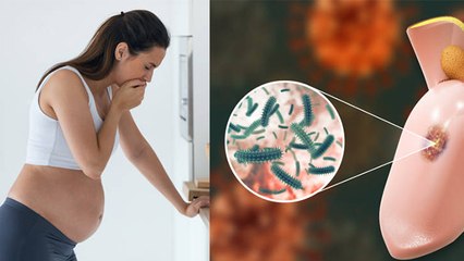 Pregnancy में Saliva बनने का Reason, प्रेगनेंसी में मुंह में ज्यादा लार बनने का कारण | Boldsky