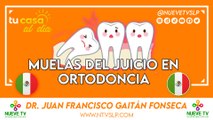 Muelas del Juicio en Ortodoncia