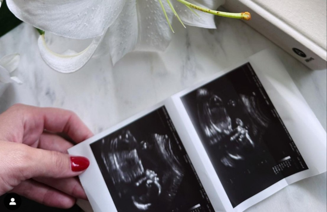 Josh Duhamel: Erstes Baby mit seiner Frau Audra