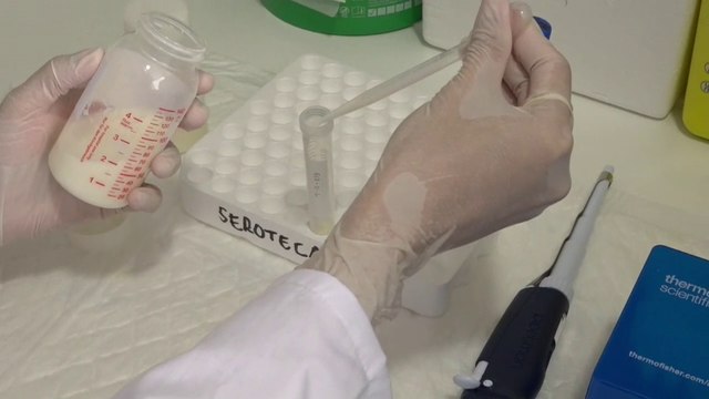 Identifican la leche materna como posible herramienta para diagnosticar el cáncer de mama