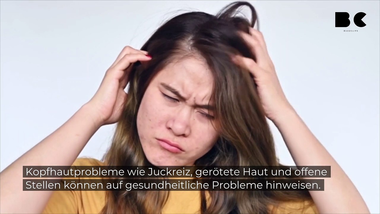 Kopfhautveränderungen: Das kann dahinterstecken!