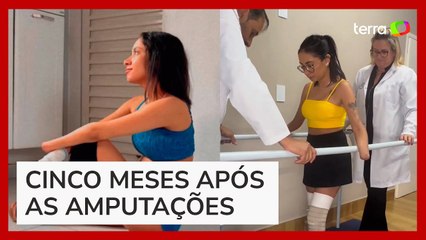 Jovem volta a andar com ajuda de prótese após ter mãos e pés amputados por infecção