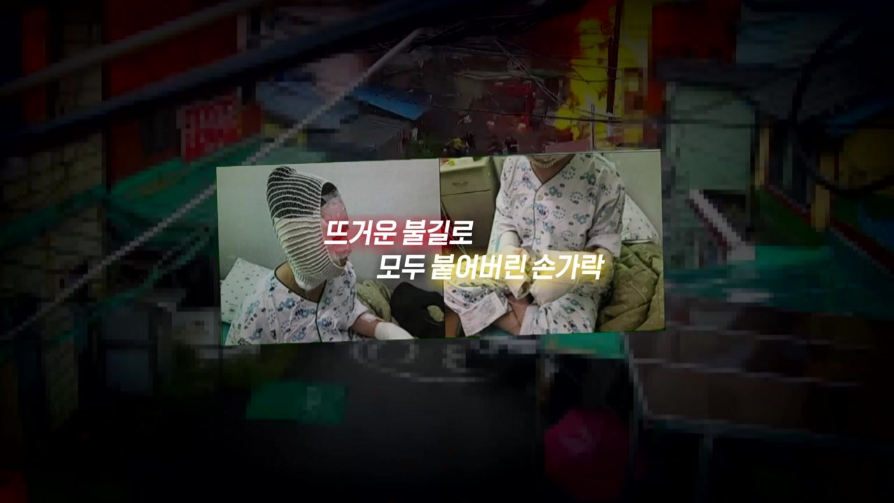 [뉴스라이더] 화재로 붙어버린 손가락..."신체 1/3 화상 입어야 간병비 지원" / YTN