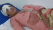मुरादाबाद: पत्नी ने गाली गलौज का किया विरोध तो शराबी पति ने कर दिया यह हाल