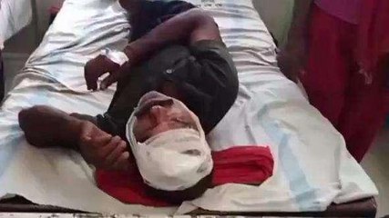 सीधी: जमीनी विवाद को लेकर हुई मारपीट, एक की हालत गंभीर