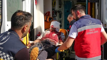 Elektrikli testere yüzünü kesti