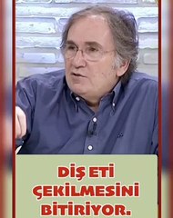 Diş eti çekilmesi için harika bir tavsiye