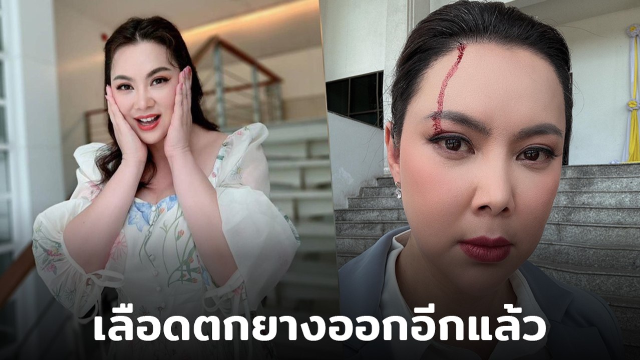 บุ๋ม ปนัดดา โพสต์คลิปหัวแตก บอกเลือดตกยางออกอีกแล้ว ทำแฟนคลับตกใจ