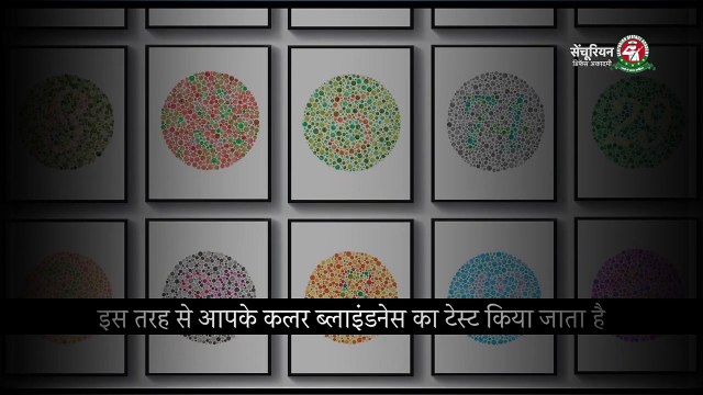 NDA Medical Procedure Full Details _ Various Types of Medical Tests in NDA _ SSB Medical #ndamedical