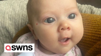 Baby girl's big blue eyes that once garnered compliments were a symptom of something more serious