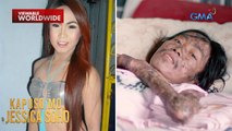 Dating kontesera, baldado na sa higaan dahil sa kanyang misteryosong sakit! | Kapuso Mo, Jessica Soho
