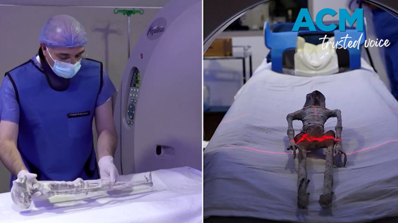'Alien' remains undergo CT scan, revealing body with eggs.