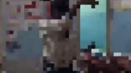 అన్నమయ్య జిల్లా: బీడీ అంటించాడు... దివ్యాంగుడికి తీవ్ర గాయాలు