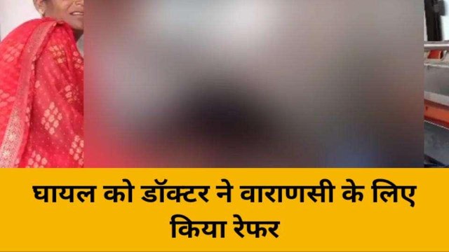भदोही: विद्युत लाइन की चपेट में आने से युवक बुरी तरह झुलसा
