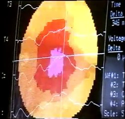 زندگی رویاها و ناخودآگاه قسمت دوم_(راههای  دستیابی به ضمیر ناخودآگاه انسان) (1)