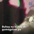 Mga doktor, na-shock sa nadiskubreng nakabara sa lalamunan ng pasyente! | GMA Integrated Newsfeed