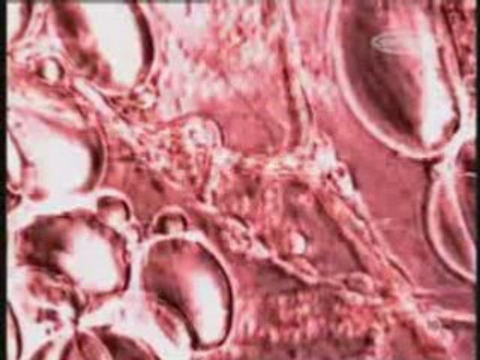 Adn menace immediate vf