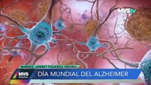 DÍA MUNDIAL DEL ALZHEIMER