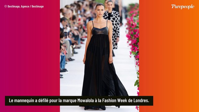 PHOTOS Irina Shayk : Le mannequin russe en plein scandale, cette étrange blessure fait jaser