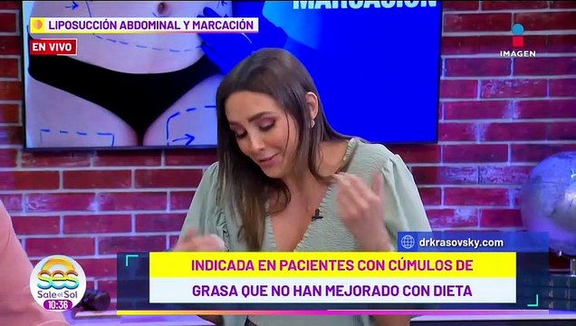 El Dr Krasovsky ACLARA todas las dudas sobre la liposucción abdominal