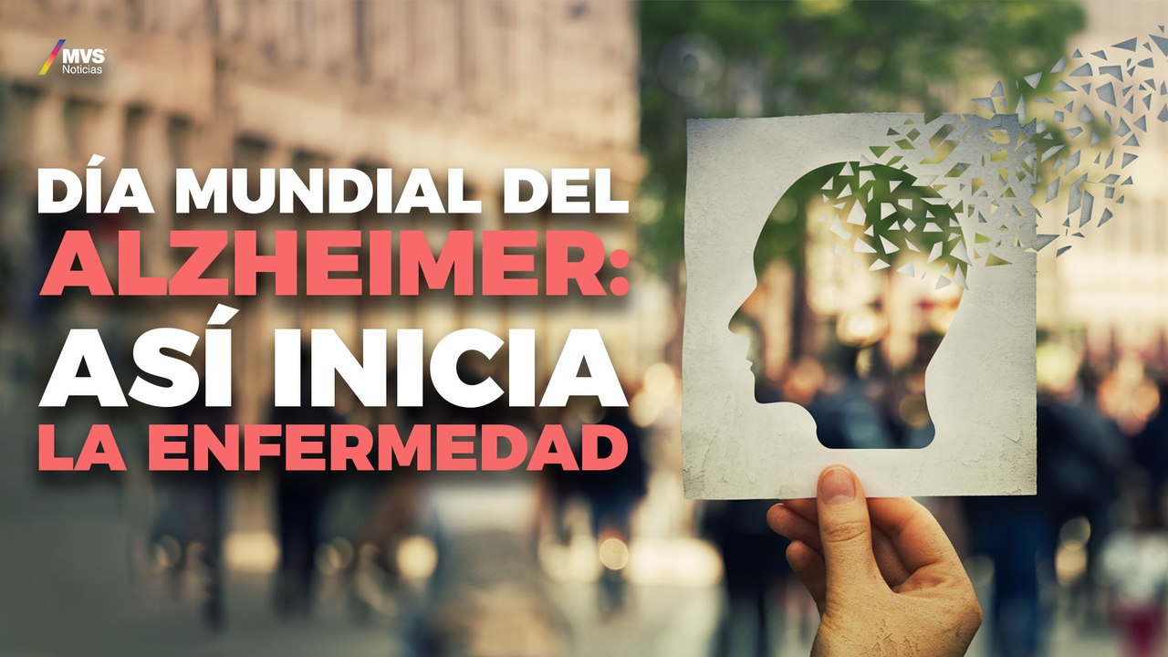 Alzheimer: estos son los FACTORES que debes de CONSIDERAR