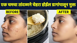 एक चमचा तांदळाने होतील चेहऱ्यावरील पिंपल्स दूर? | Smooth And Glowing Skin Tips | Rice Face Pack AI2