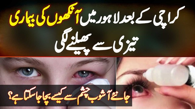 Eye Infection in Lahore | Ashob E Chashm Se Kaise Bacha Ja Sakta Hai | Eye Disease in Lahore