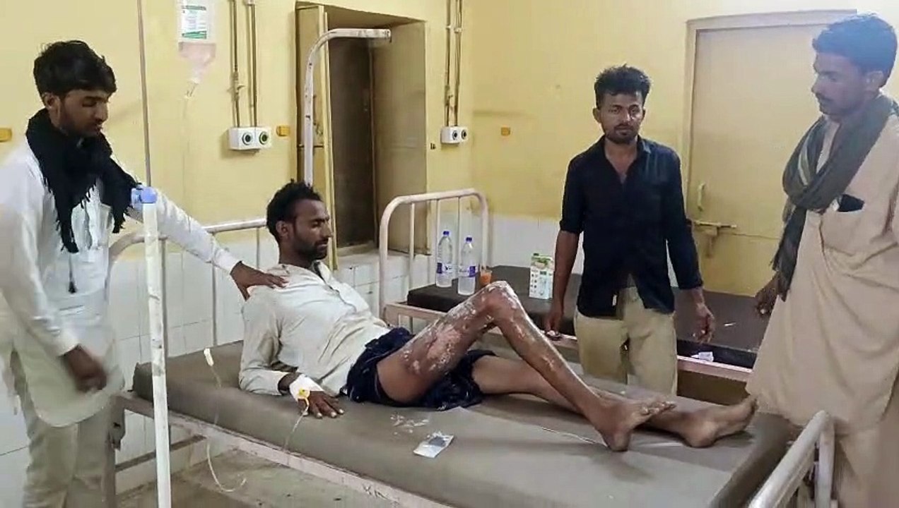 चलती बाईक में बोतल से पेट्रोल डालने के दौरान लगी आग, बाईक के चालक भी आया चपेट में