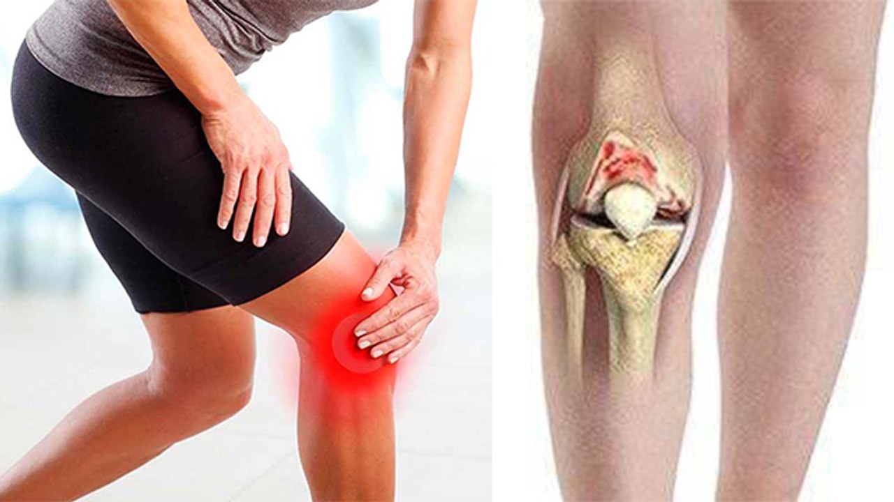 Knee Stiffness Reason In Hindi: Ghutna Jam Kyu Hota Hai | घुटना जाम होने पर क्या करें | Boldsky