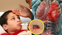 Kids में Multi Organ Failure क्यों होता है | Dengue Multi Organ Failure Syndrome kya hota h|Boldsky