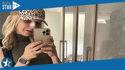 Familles nombreuses : Ambre Dol partage un premier cliché après son opération du nez