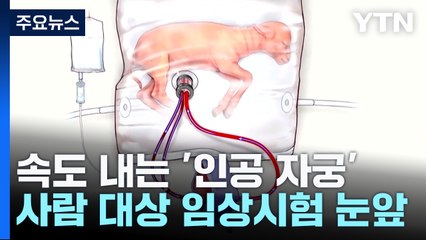 [과학 한스푼]엄마 몸 밖 또 하나의 자궁...'인공 자궁' 임상시험 눈앞 / YTN
