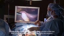 Liver Transplant  A Life Saving Procedure (4 Minutes Microlearning)