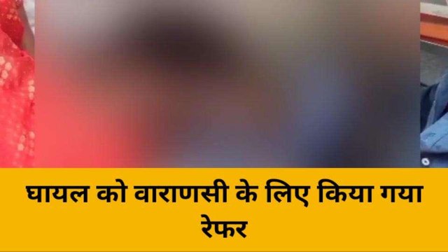 भदोही: विद्युत करंट से युवक झुलसा, गंभीर हालत में अस्पताल लेकर पहुंचे परिजन