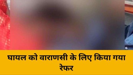 भदोही: विद्युत करंट से युवक झुलसा, गंभीर हालत में अस्पताल लेकर पहुंचे परिजन
