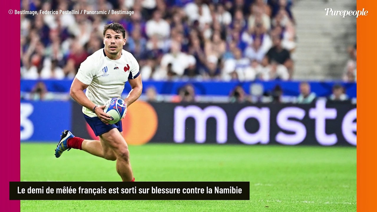 Antoine Dupont, 2 plaques posées sur sa mâchoire fracturée : "Ca peut être douloureux à chaque effort"