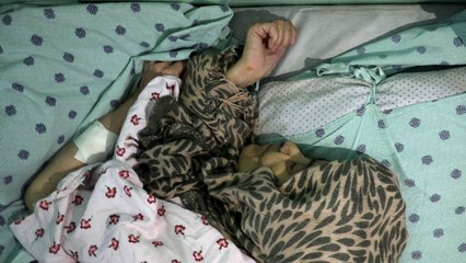 Afganistan'da ailesinin 25 yıldır bir odada hapsettiği Nikbaht kurtarıldı