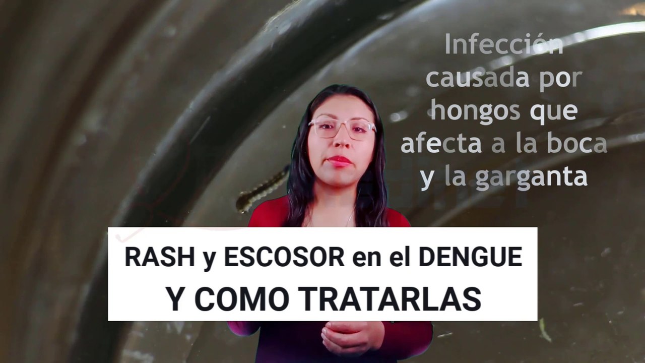RASH y PICAZÓN en el DENGUE: POR QUÉ OCURRE y CÓMO HACER que DESAPAREZCA